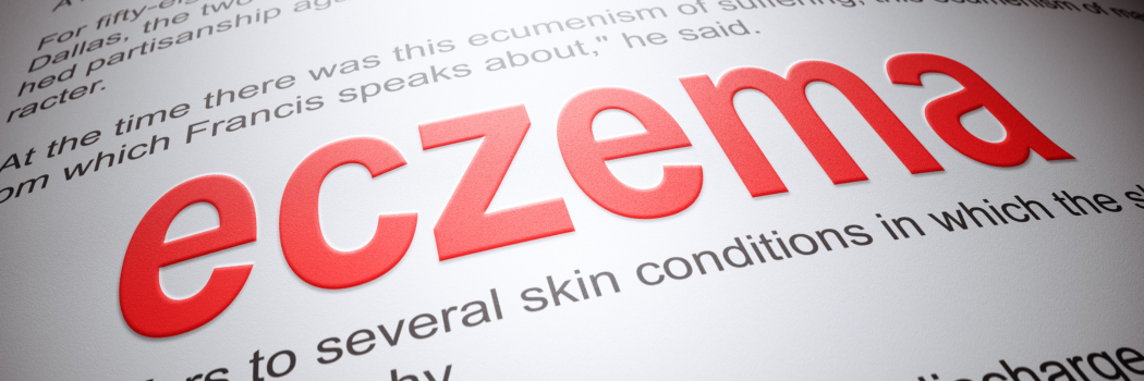 Eczema blog photo